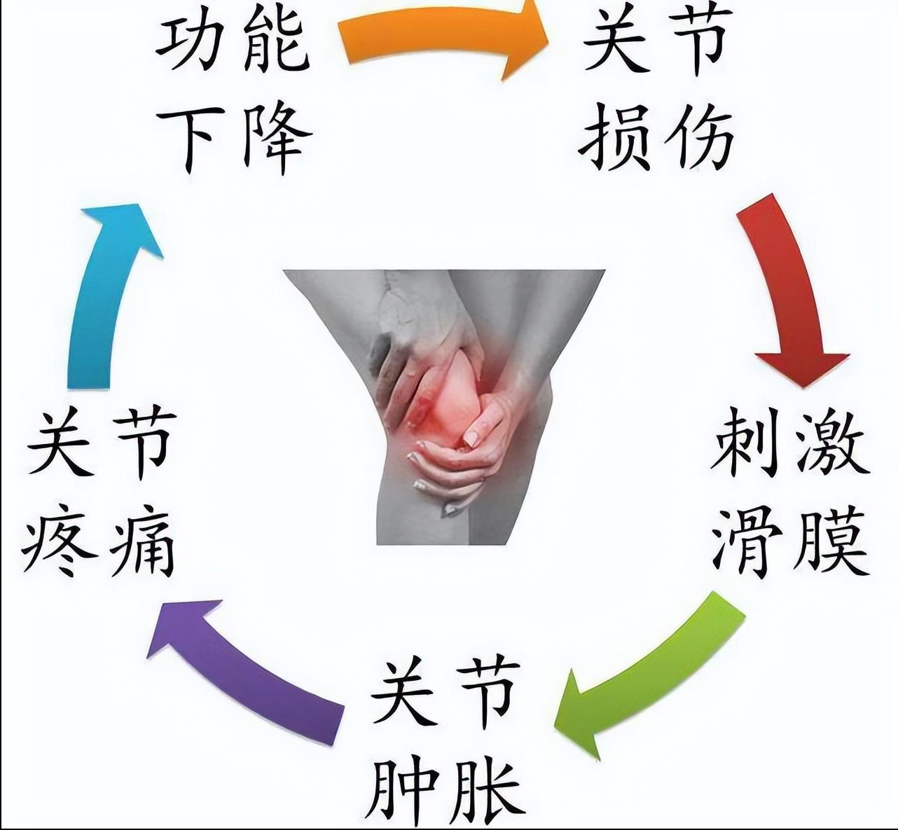 Repeated torment of joint effusion?9 Ways to Help You Relieve iNEWS