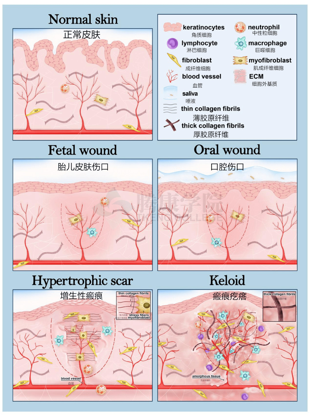 Scar Shape Classification Treat scars quickly before midsummer - iMedia