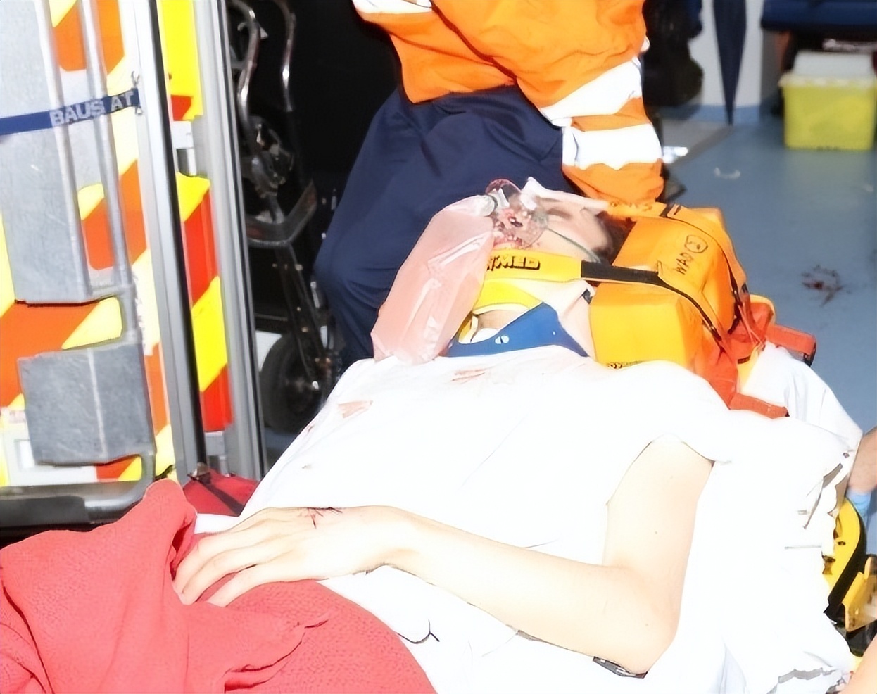 Mirror concert accident Dancer's cervical spine burst or will be