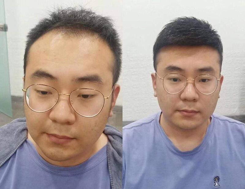 How much is a custommade male wig?How long does a custom wig usually