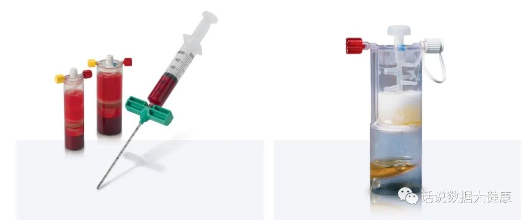 Autologous protein injection, an early solution for osteoarthritis? - iNEWS