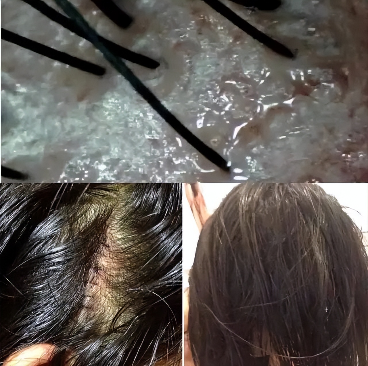 The scalp is oily and smelly, it is actually "it" that is making