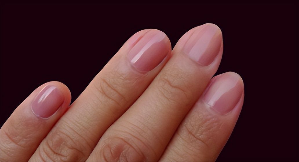 There is a black line on the baby's fingernail, is it melanoma? iMedia