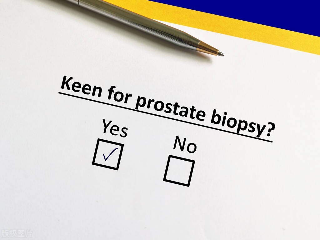 What Is A Prostate Biopsy How Does It Work What Are The Risks Inews