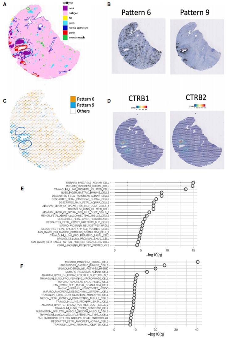 AI uses transcriptomics data to infer molecular changes in cell-cell ...