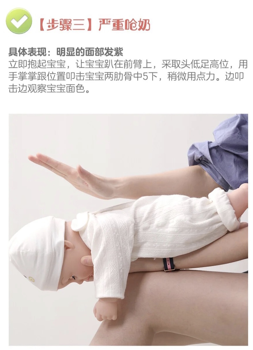 First aid tips for baby choking milk iNEWS