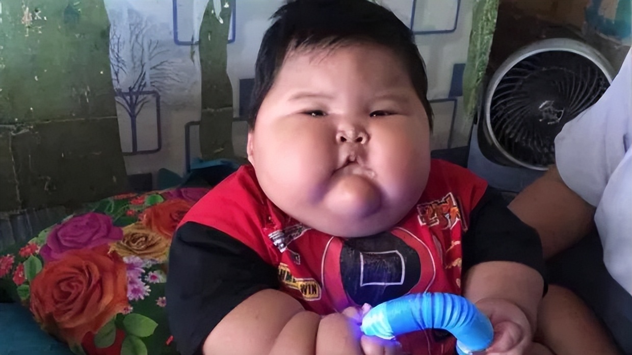 The 16-month-old "giant baby" in Indonesia weighs 27 kg, wears XXXL diapers and directly wears dad's clothes!