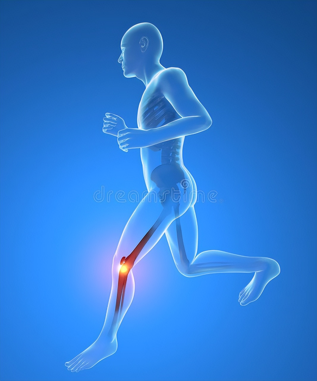 Does running hurt your knees? iNEWS