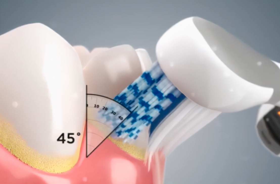 What are the advantages and disadvantages of electric toothbrushes?A