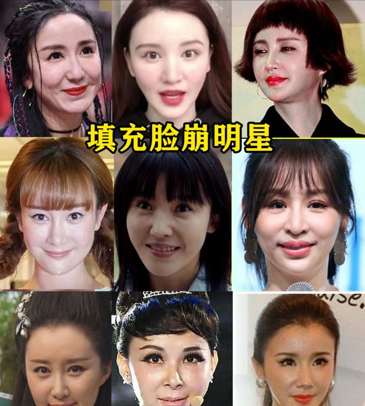Which celebrities' faces have/are about to collapse? - iMedia