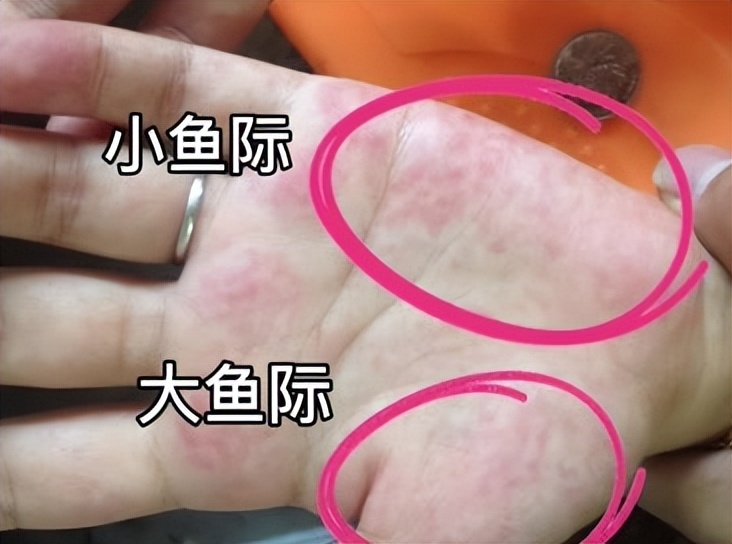 Liver diseases are all protracted, if there are 4 abnormalities, don't ...