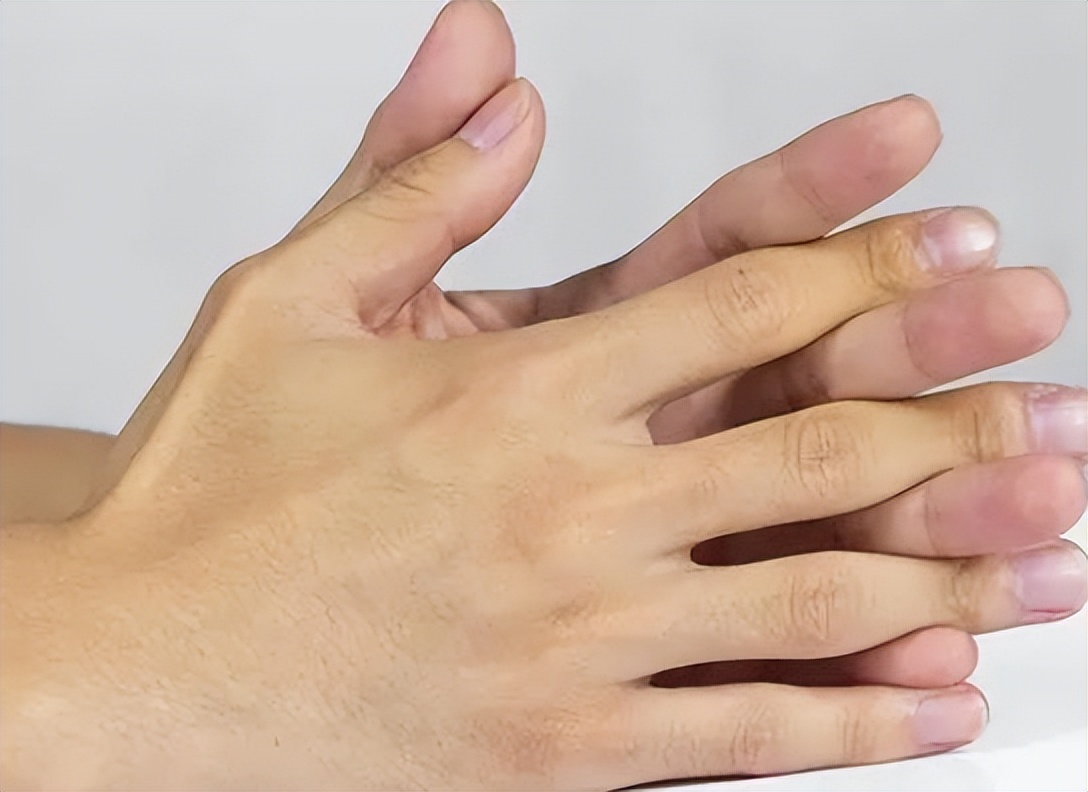 pain-in-finger-joints-what-disease-does-it-suggest-doctor-if-you