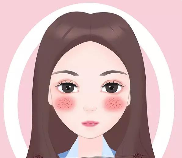 Facial rednessa winter nightmare iNEWS