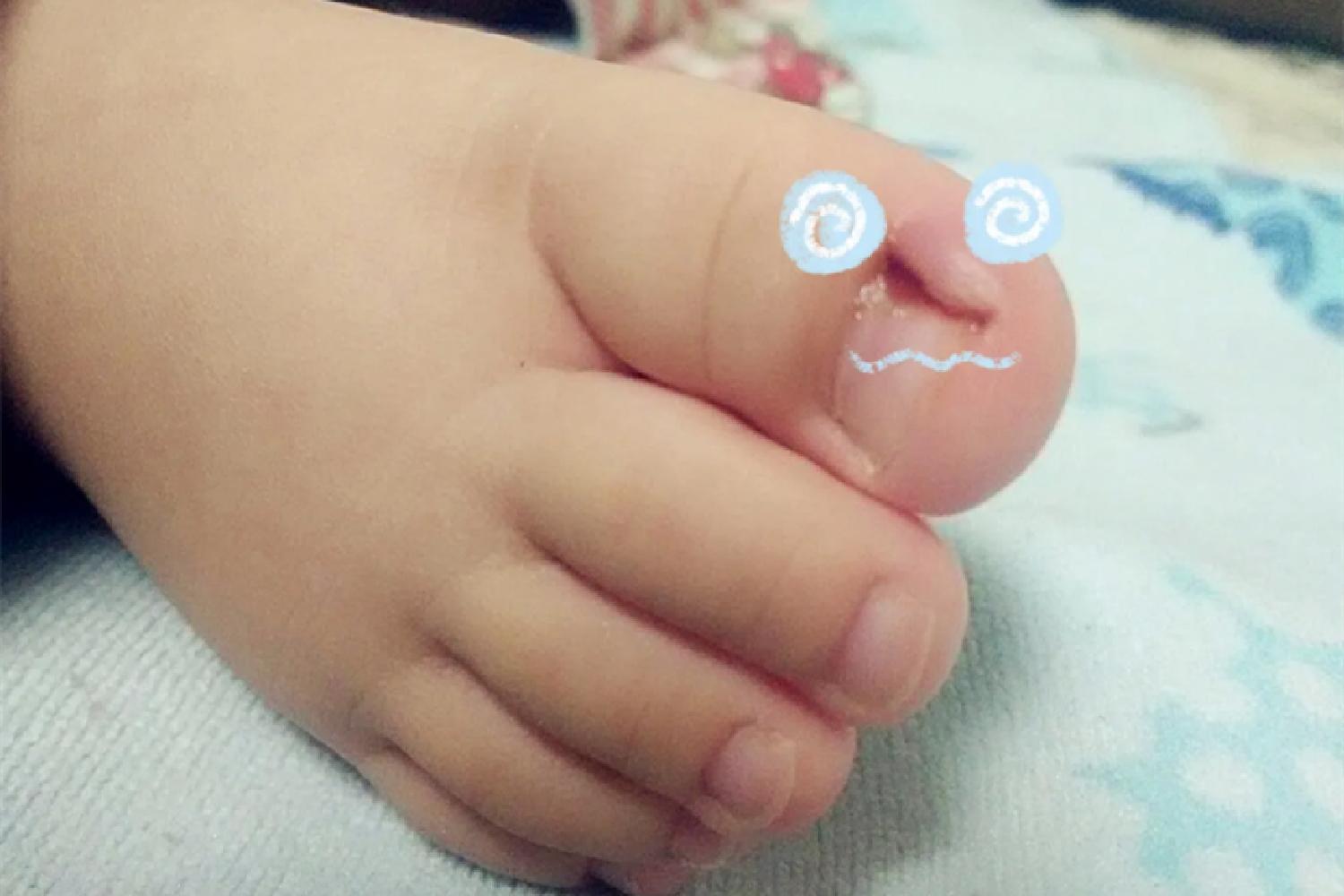 Cutting baby's nails is not just a matter of scissors, the wrong way