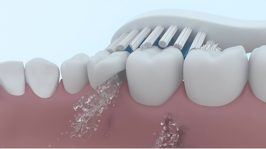 Can an electric toothbrush hurt your gums?Stomatologists reveal the