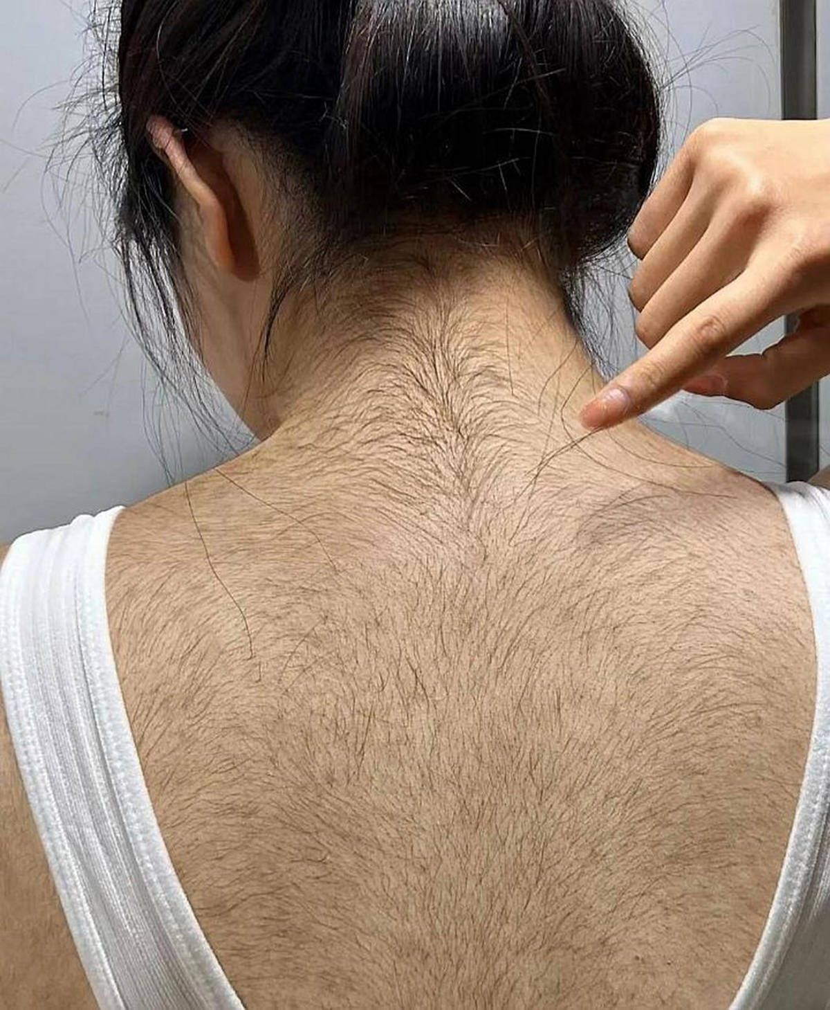 Why do Caucasians have more body hair than our yellow race? Is it