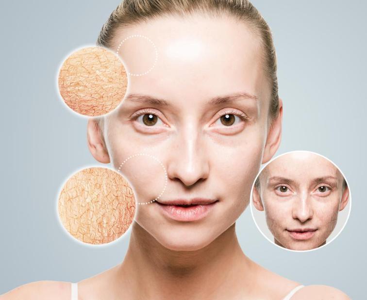 Who is healthier, sweating a lot or not sweating? Can sweating a lot