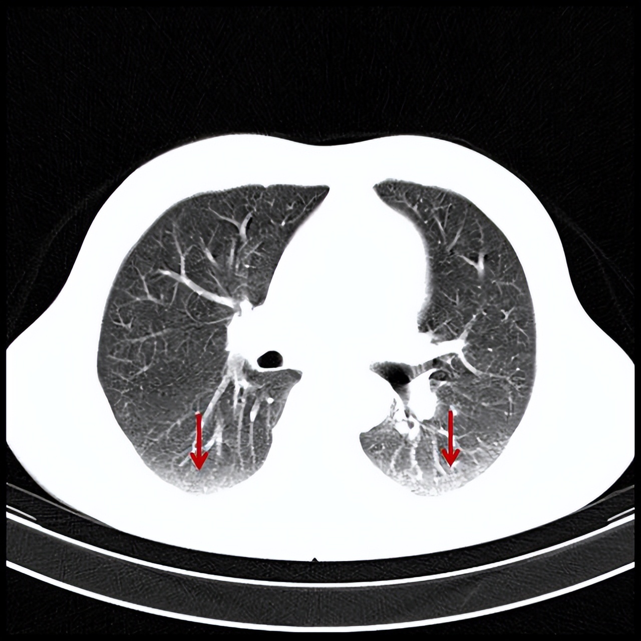 Smokers give their lungs a "bath" to make their lungs better and better