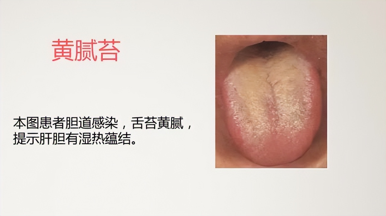 What are the manifestations of liver and gallbladder damp heat? Chinese