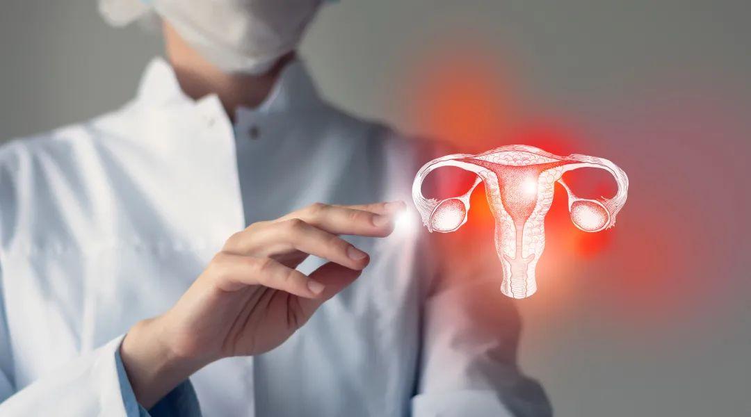 Why do women get ovarian cysts?May be these 5 reasons - iMedia