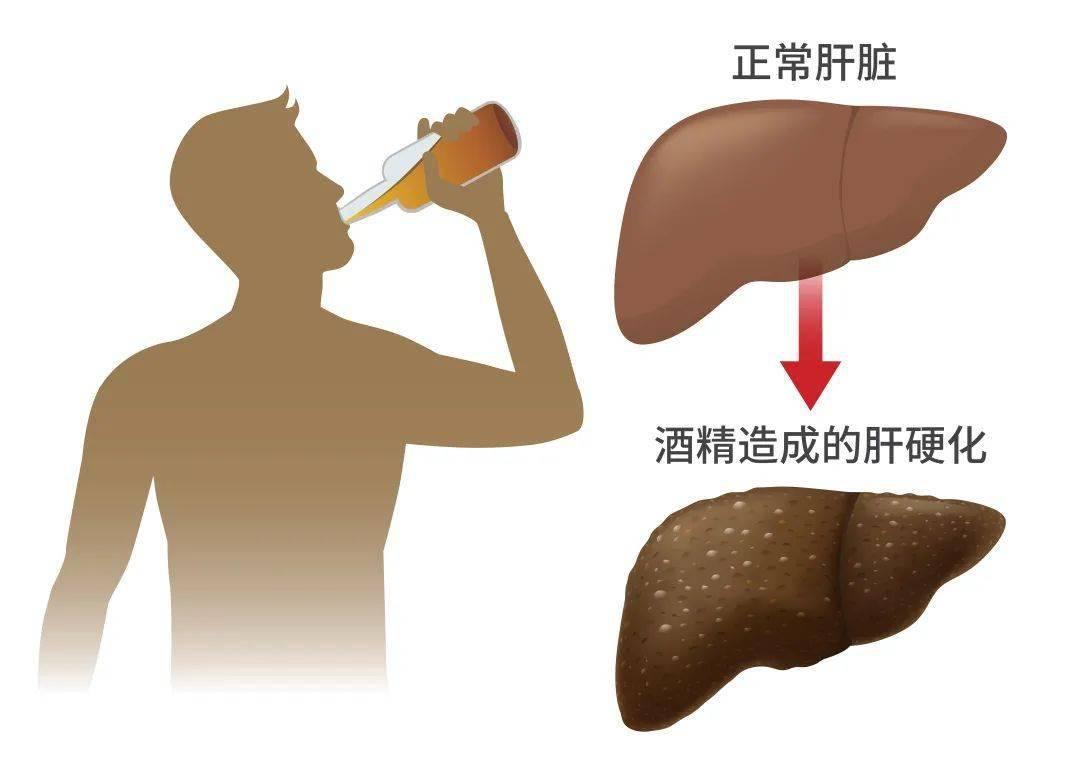 Why can't you touch peanuts while drinking? Doctor Drink as little as