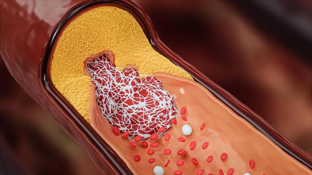 Aspirin, taking before and after meals, the effect is very different