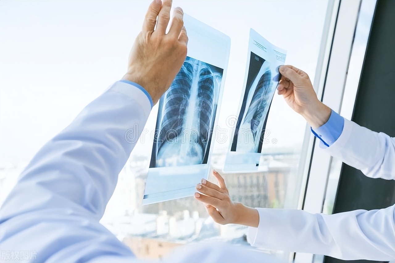 Can general physical examination detect cancer? What do you know about ...