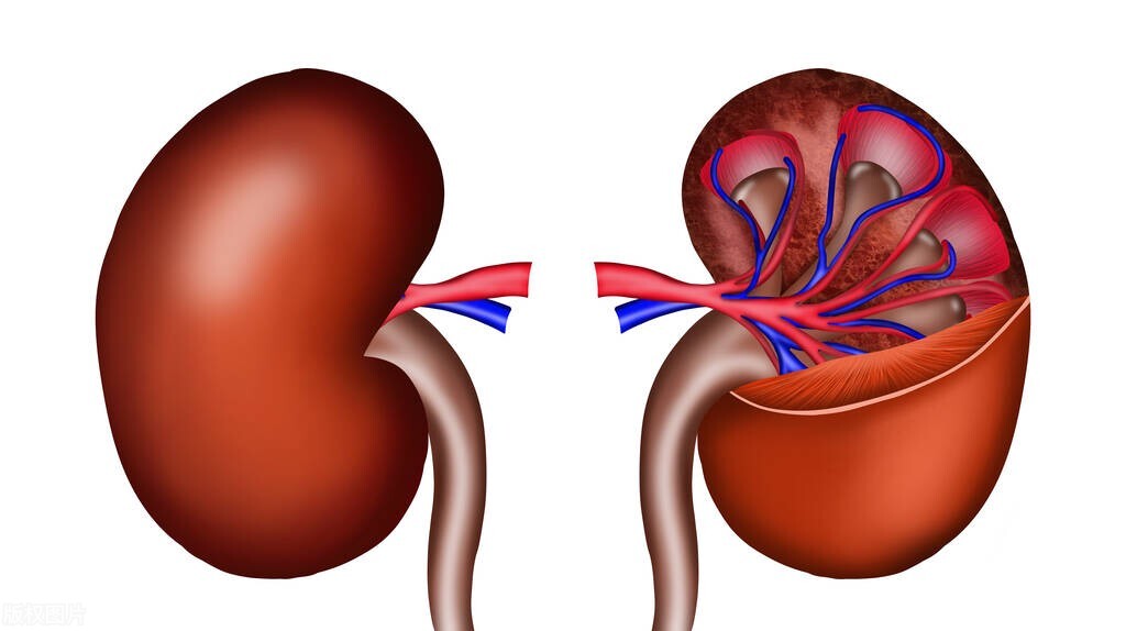 No three highs, kidney disease, how come calcium deficiency ...