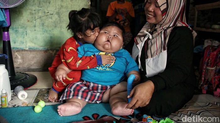 The 16-month-old "giant baby" in Indonesia weighs 27 kg, wears XXXL diapers and directly wears dad's clothes!