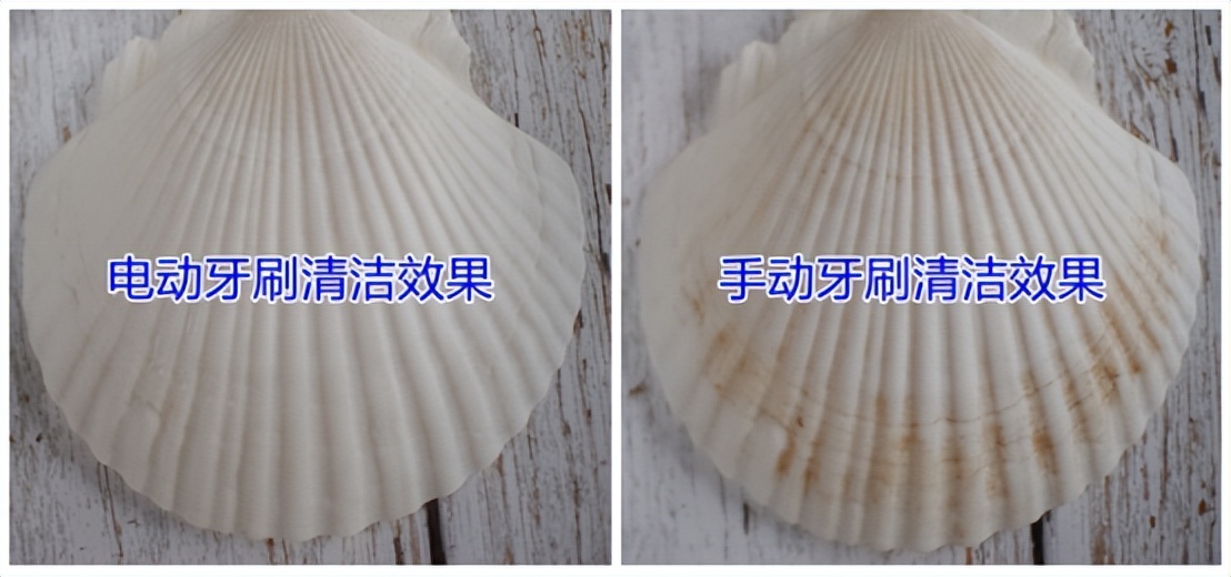 Is it harmful to teeth with electric toothbrush? Indepth study of the