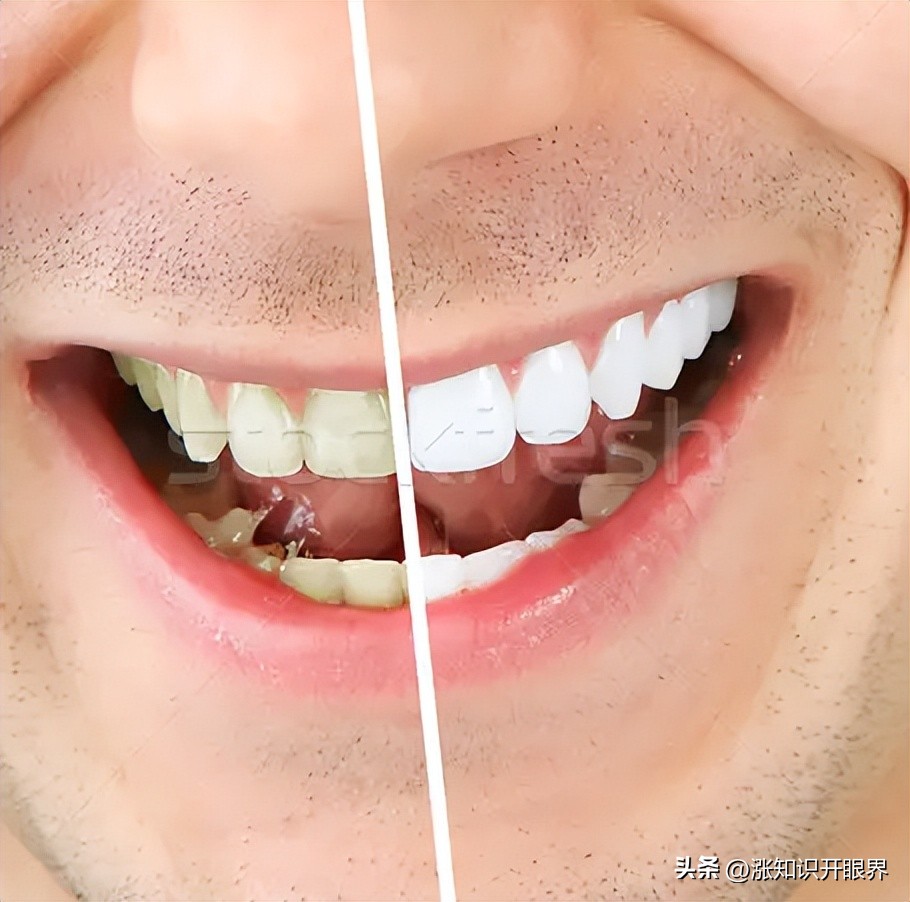 What Unexpected Symptoms Could Happen If You Don't Brush Your Teeth All