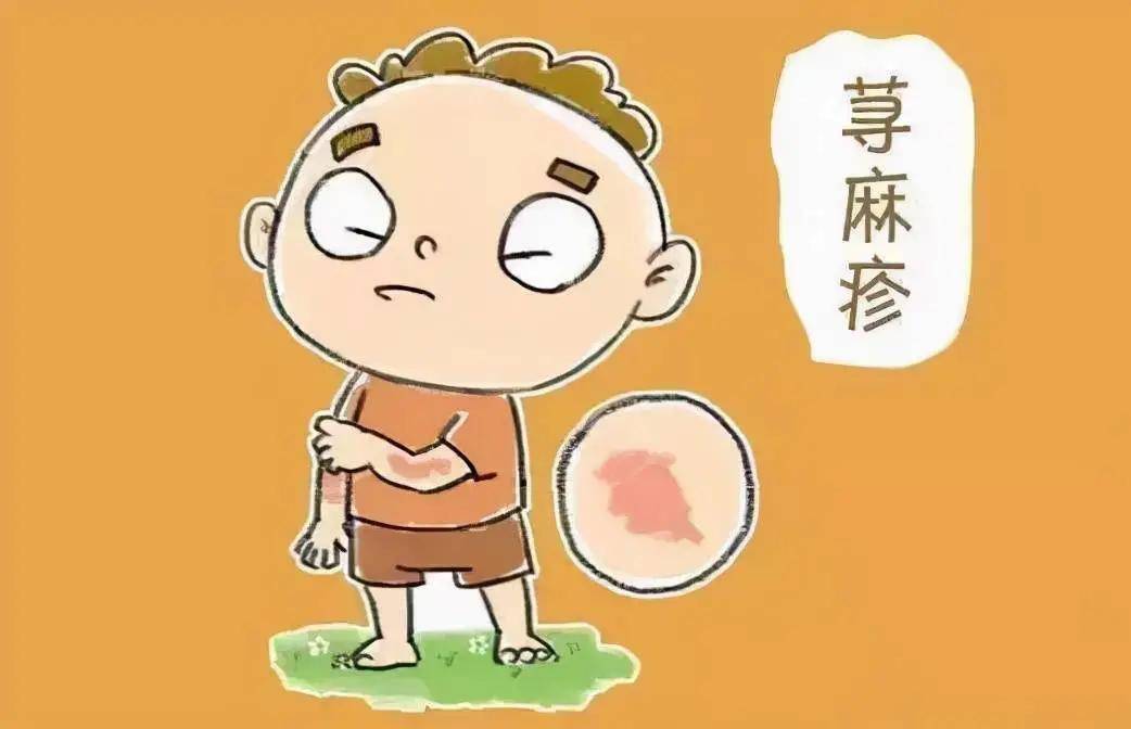 What disease can cause itchy skin? iNEWS