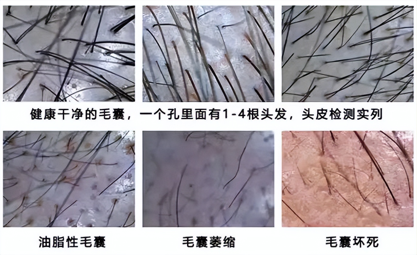 What does hair follicle testing do?Why did the doctor want you to do a