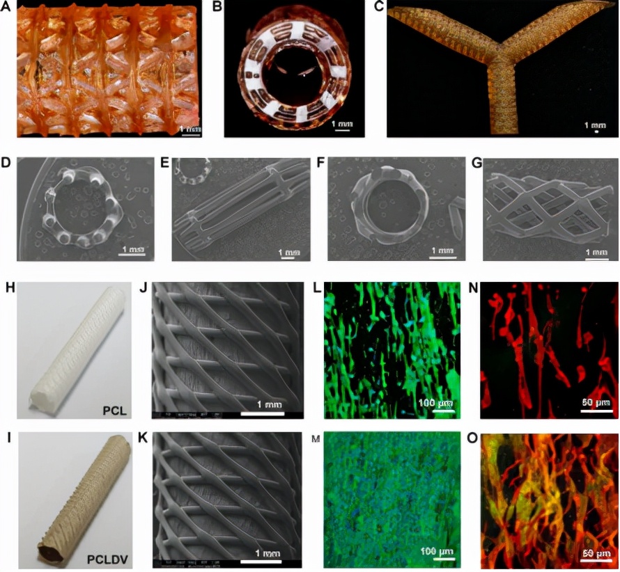 Biological preparation of small diameter tissue engineering vascular ...