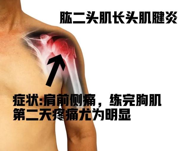 Shoulder joint pain and caused by exercise, stretching and