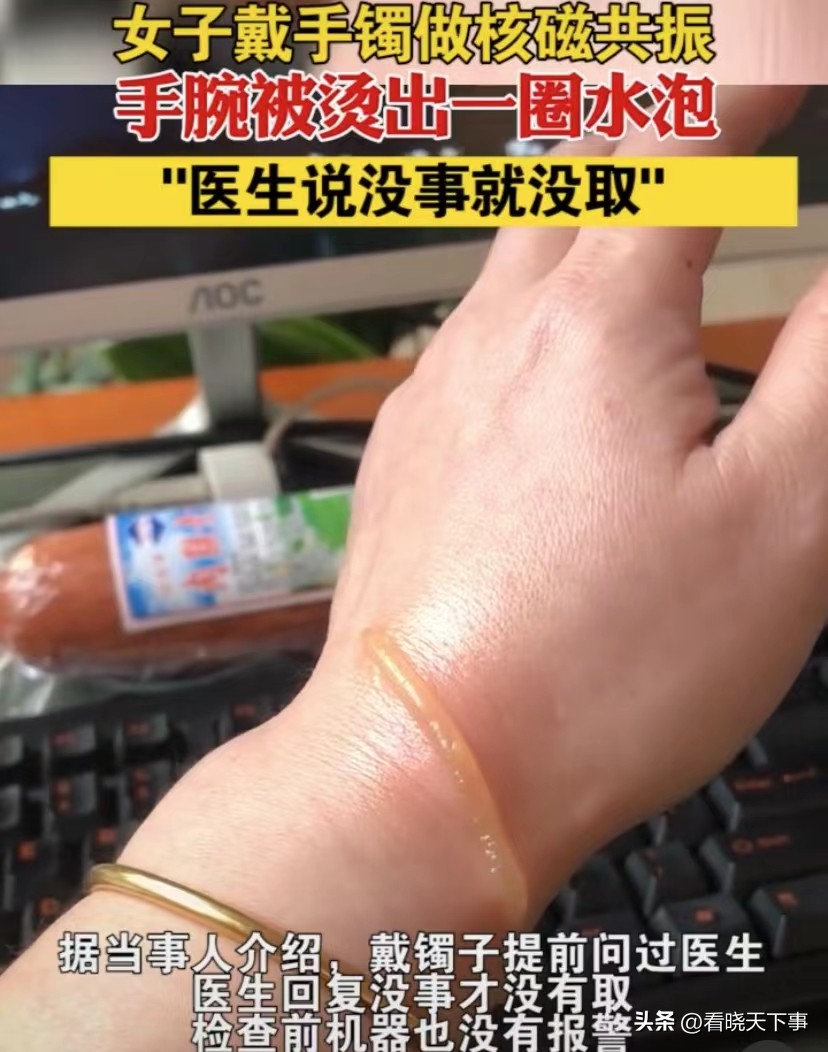 Is it okay to wear pure gold jewelry for an MRI scan? iNEWS