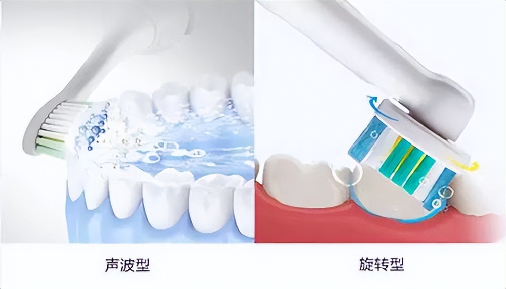 Which brand of electric toothbrush is good?Measured 30