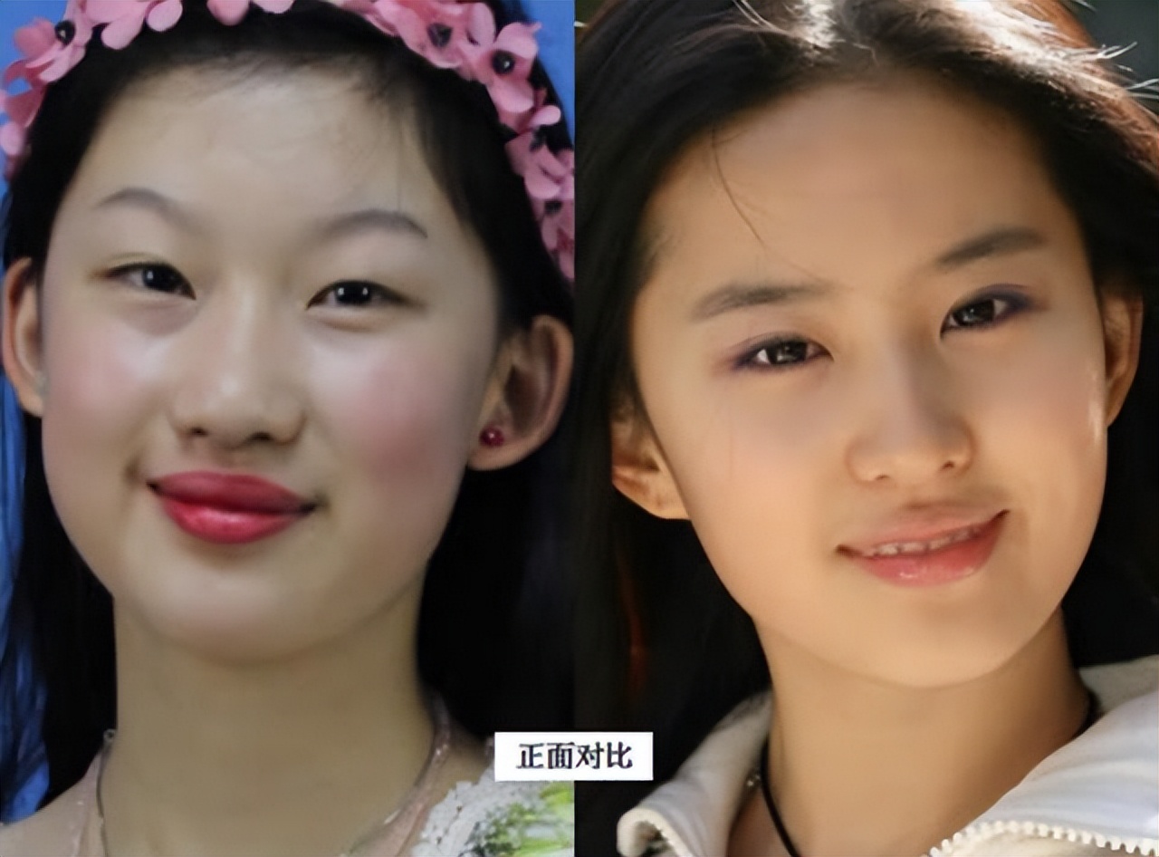 At the age of 19, she started plastic surgery to become 