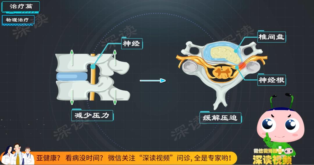 How to do lumbar disc herniation? Massage? massage? Or surgery? Count