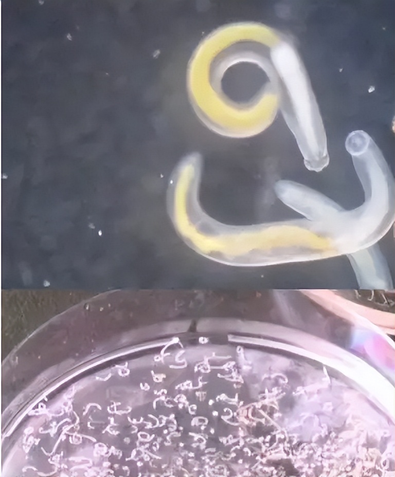100degree boiling water boils undead parasites, jawstomach nematodes