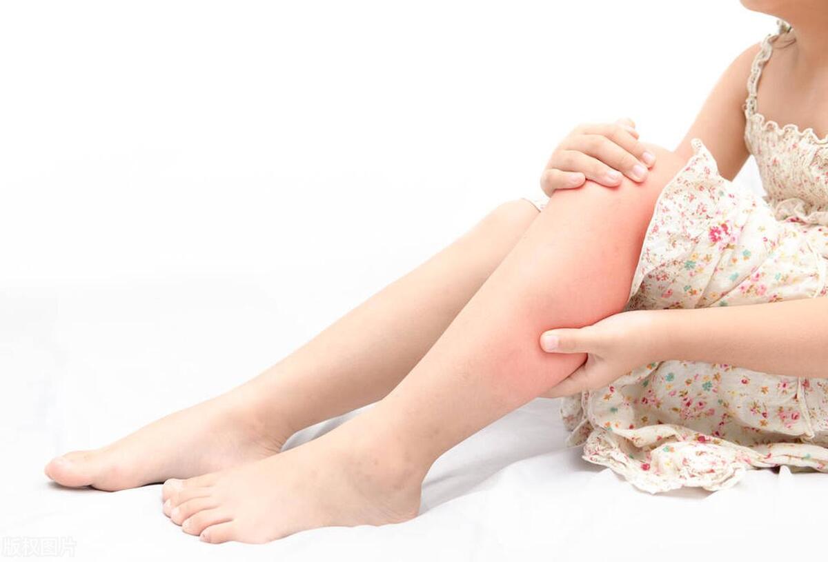 gabapentin bei herpes zoster