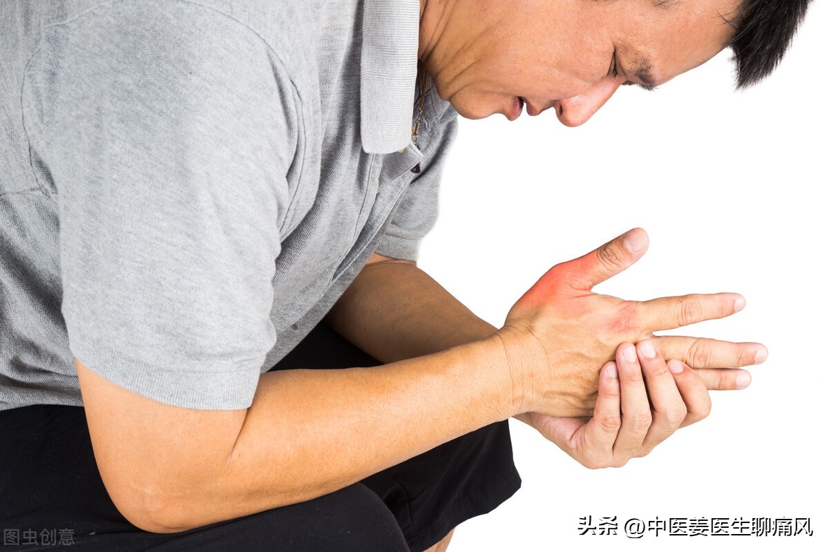 30 Year Old Xiao Peng Has Suffered From Gout For 6 Years Tophi In The Right Wrist And Uric 8806