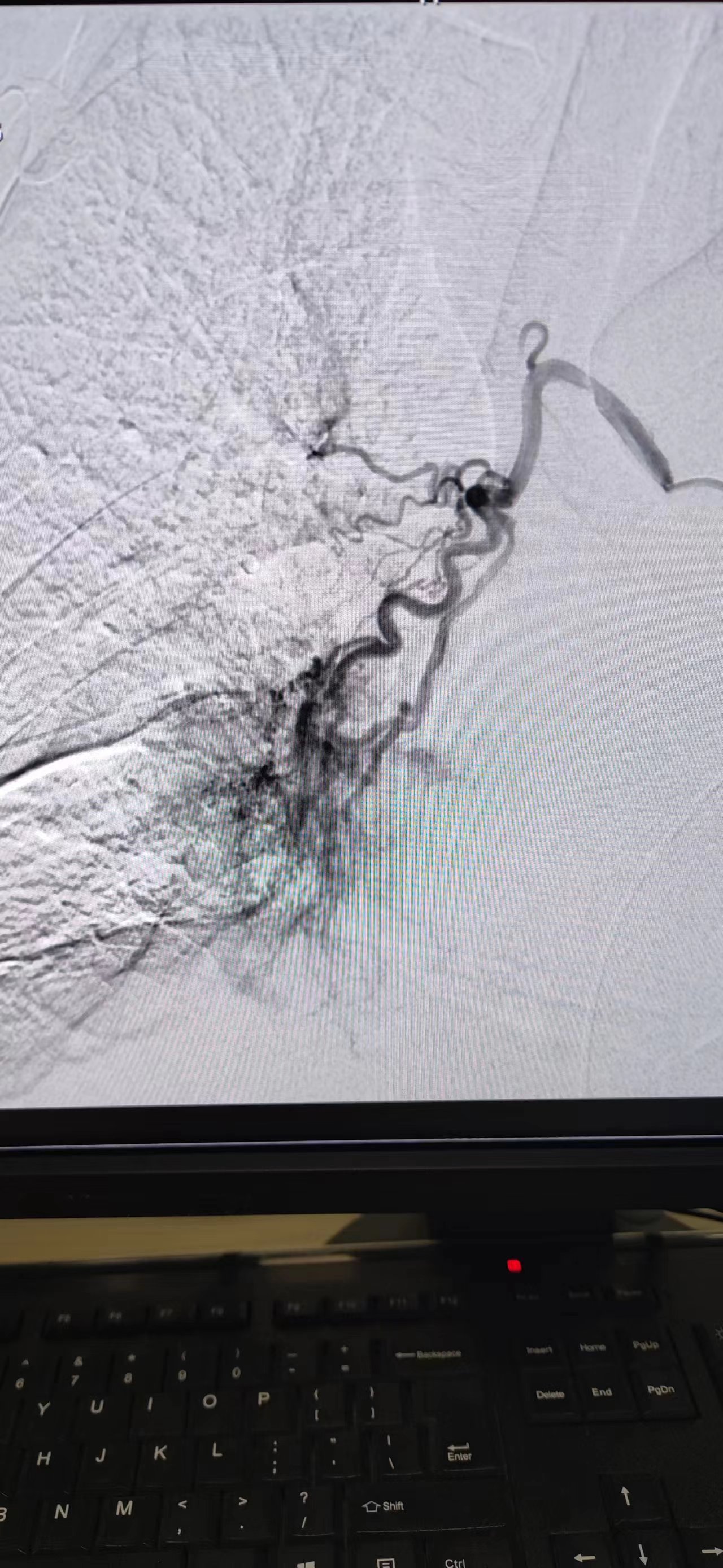 How can oncology treat a 40-year-old patient with lung adenocarcinoma ...