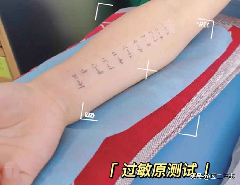 A patient with skin rash, blood in stool and fever iMedia