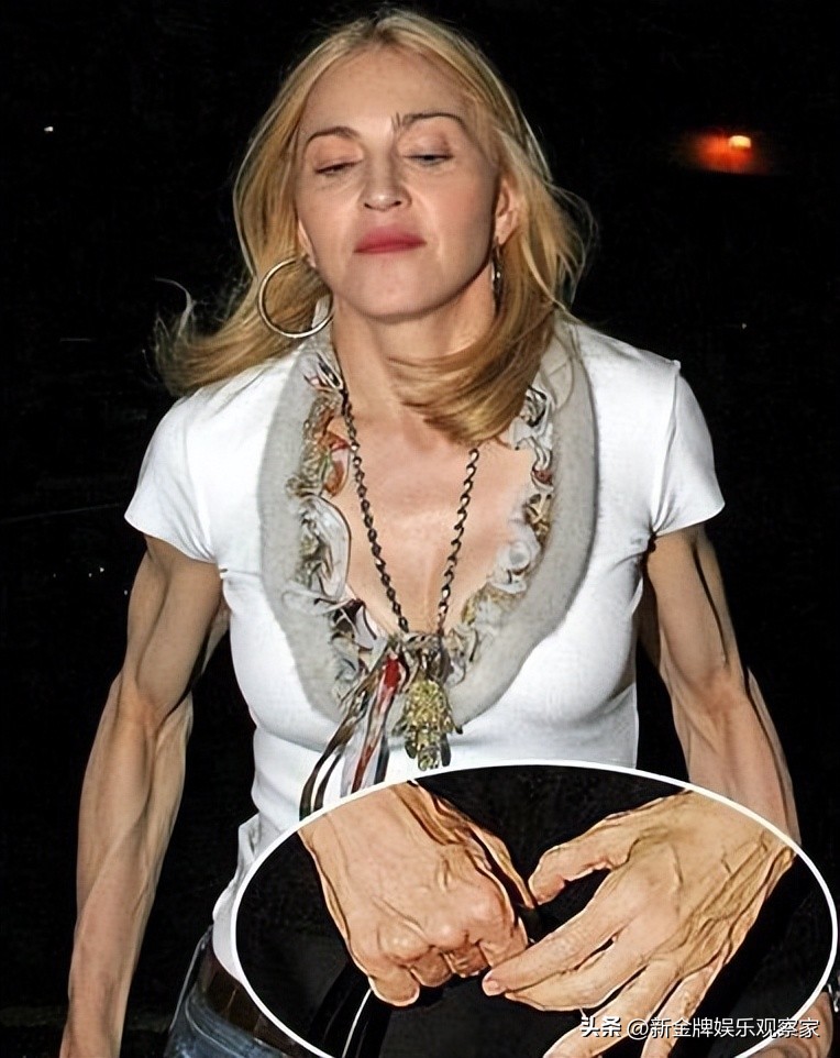 After Being Sent To The Icu Madonna Reported That She Was Safe And