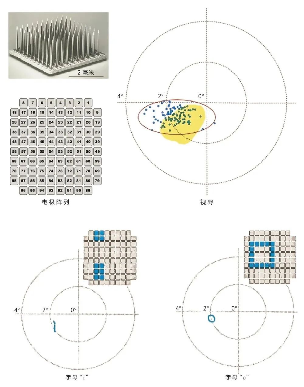 Brain-computer interface and visual prosthesis - iMedia