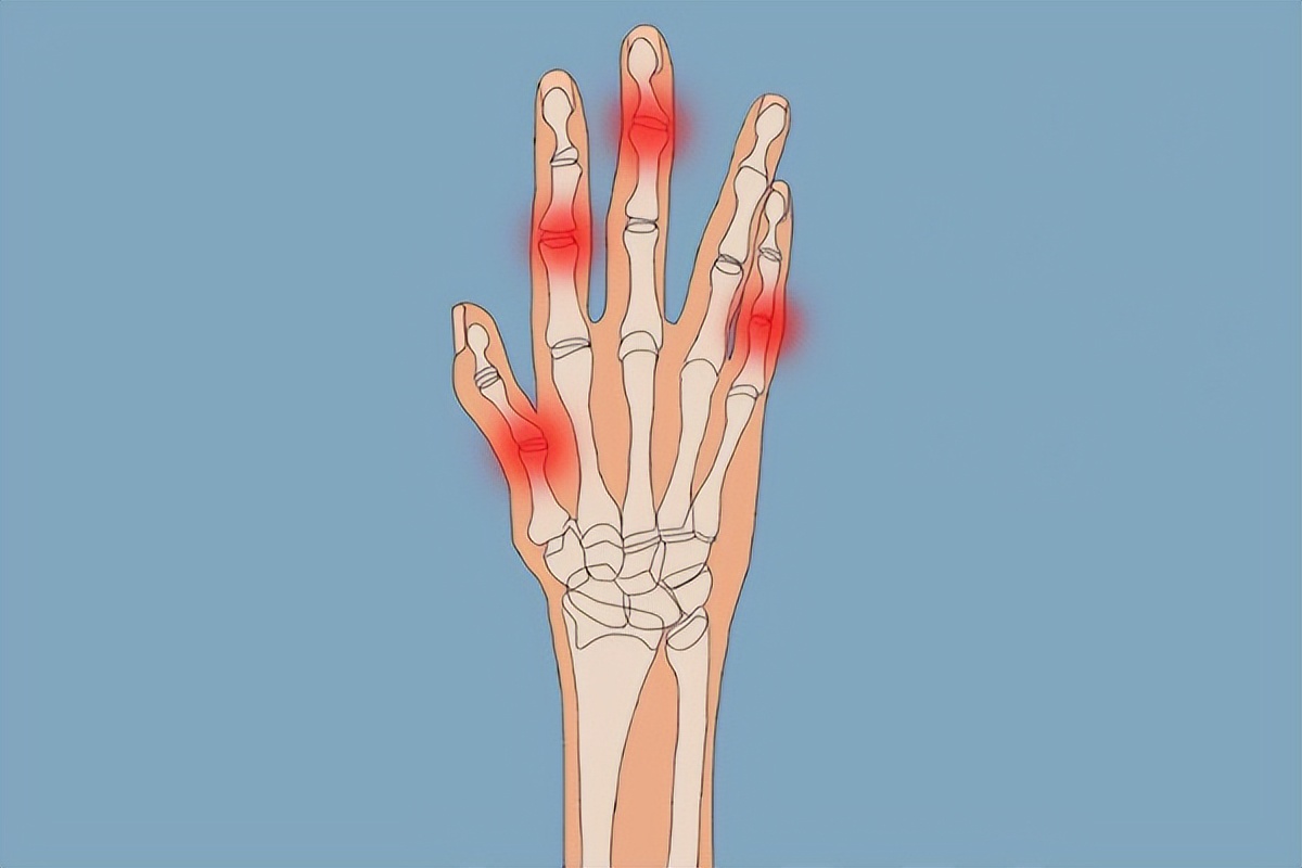 Finger joint pain, doctors find out 4 common causes! If you are