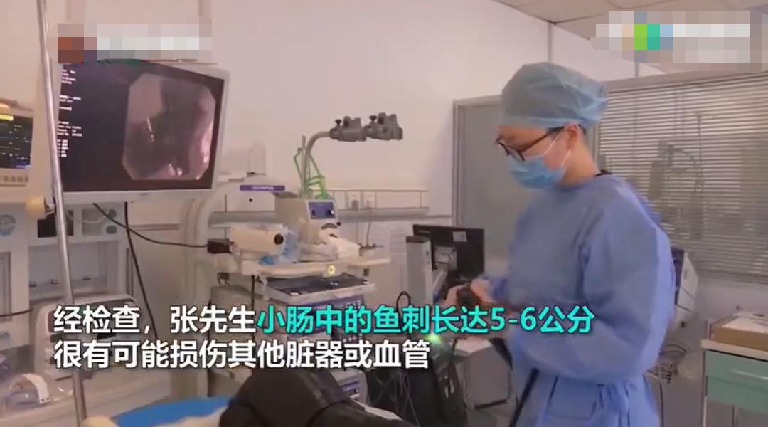 5-year-old child's fishbone stuck in throat, mother's textbook-level ...