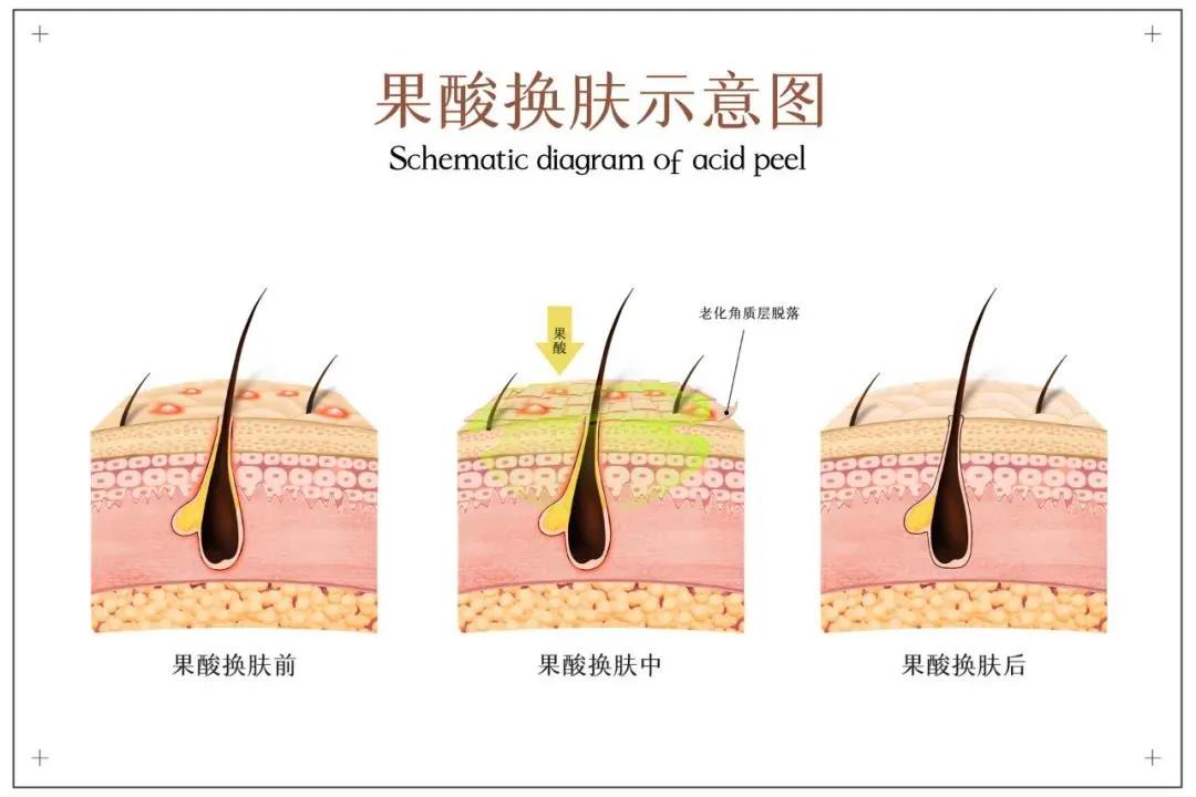 How to use fruit acid?You can be beautiful and you can ruin you - iNEWS