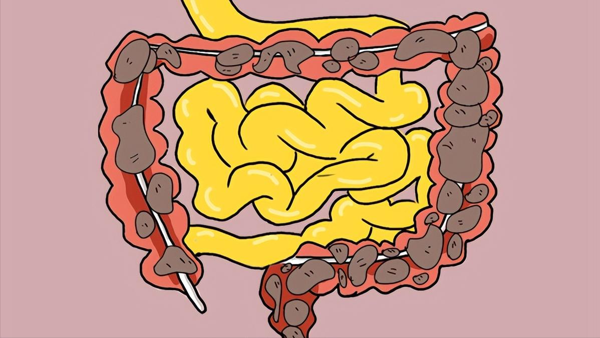 What's the matter with the stool "hard in the front, soft and sticky in